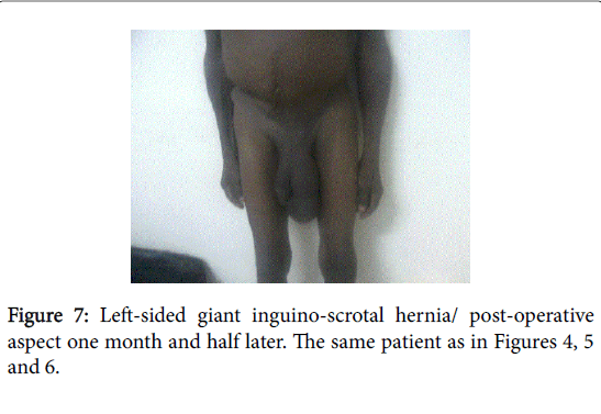 gastrointestinal-digestive-system-inguino-scrotal