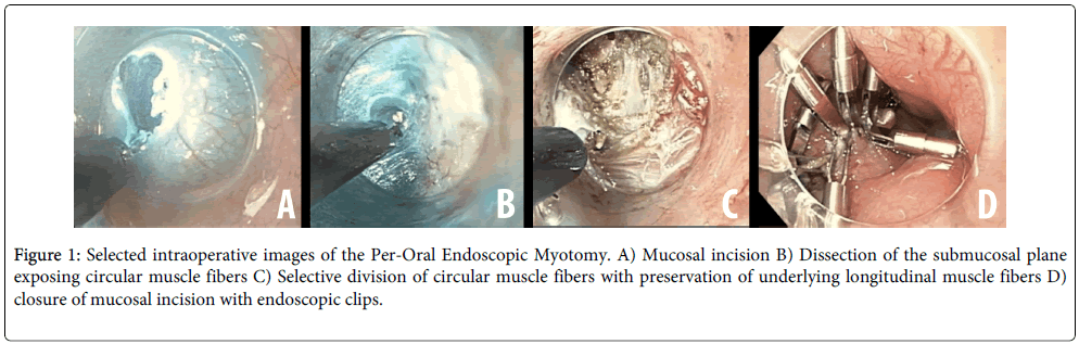 gastrointestinal-digestive-system-intraoperative-images