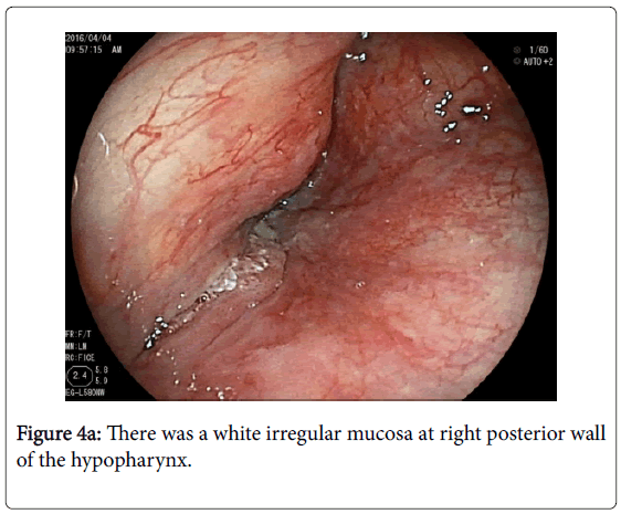 gastrointestinal-digestive-system-irregular-mucosa