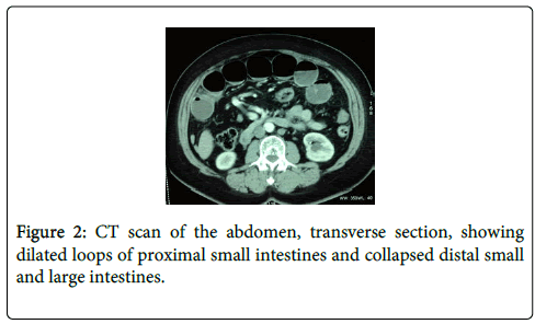 gastrointestinal-digestive-system-large-intestines