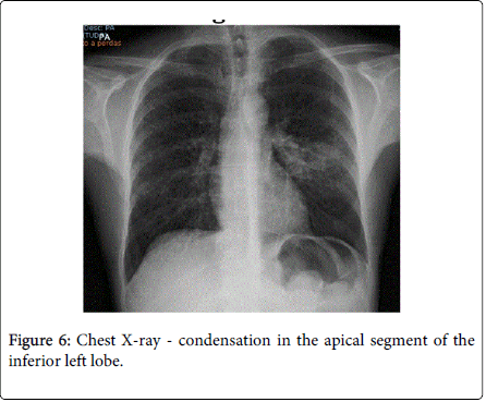 gastrointestinal-digestive-system-left-lobe
