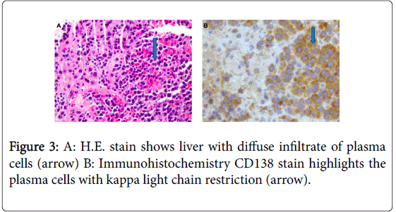 gastrointestinal-digestive-system-light-chain