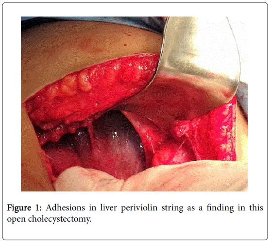 gastrointestinal-digestive-system-liver-periviolin