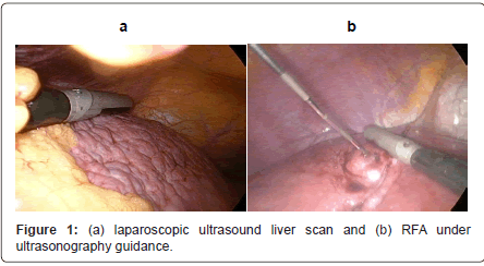 gastrointestinal-digestive-system-liver-scan