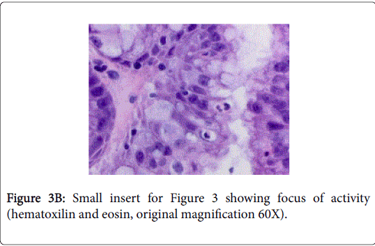gastrointestinal-digestive-system-magnification