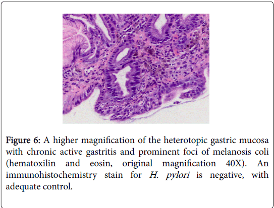gastrointestinal-digestive-system-magnification