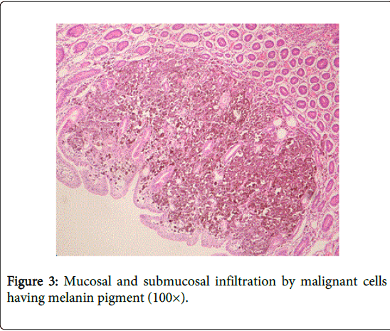 gastrointestinal-digestive-system-melanin-pigment