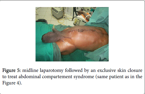 gastrointestinal-digestive-system-midline-laparotomy