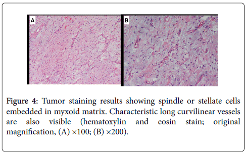 gastrointestinal-digestive-system-myxoid-matrix