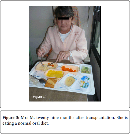 gastrointestinal-digestive-system-nine-months