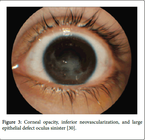 gastrointestinal-digestive-system-oculus-sinister