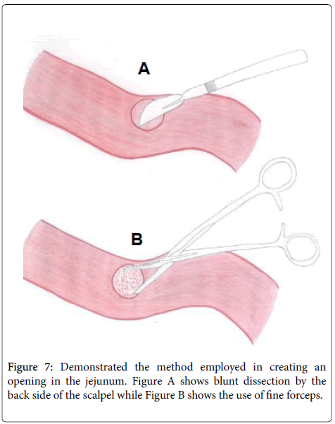 gastrointestinal-digestive-system-opening-jejunum