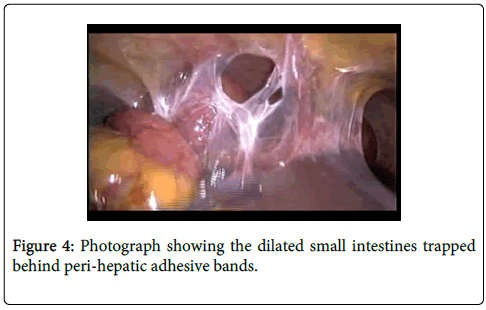 gastrointestinal-digestive-system-peri-hepatic