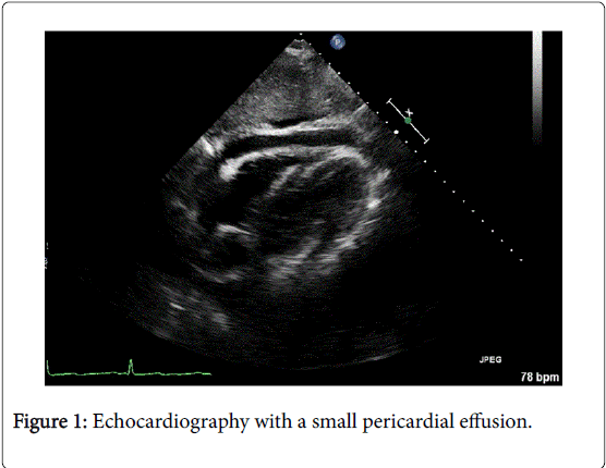 gastrointestinal-digestive-system-pericardial-effusion