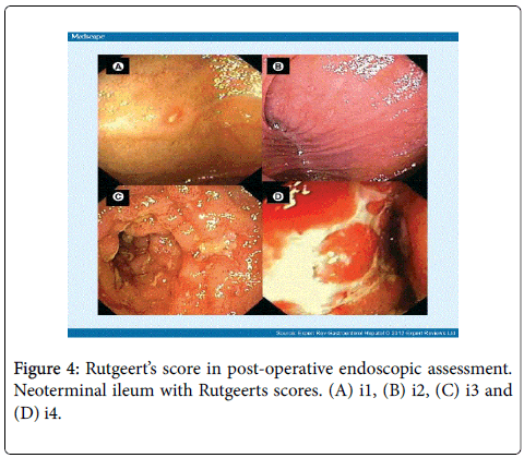 gastrointestinal-digestive-system-post-operative
