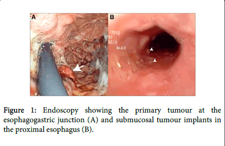 gastrointestinal-digestive-system-proximal-esophagus