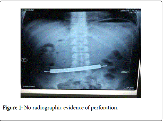 gastrointestinal-digestive-system-radiographic-evidence