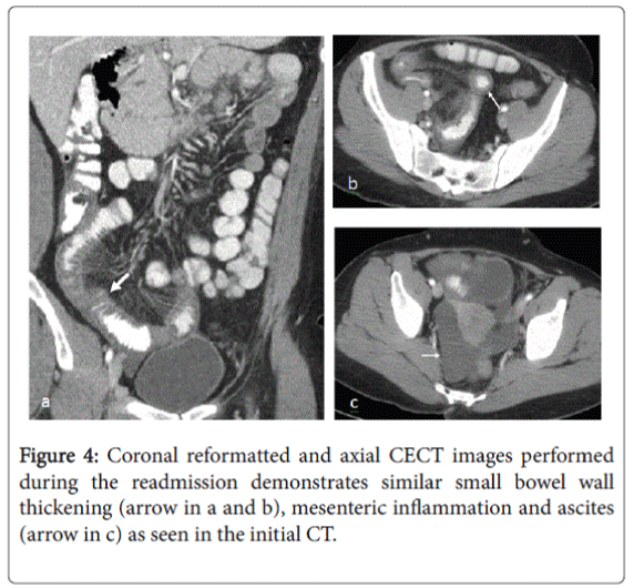 gastrointestinal-digestive-system-readmission-demonstrates