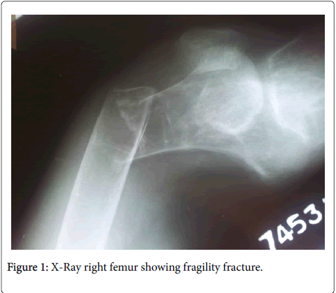 gastrointestinal-digestive-system-right-femur