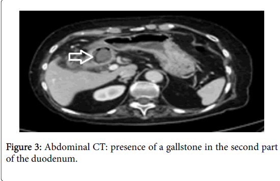 gastrointestinal-digestive-system-second-part