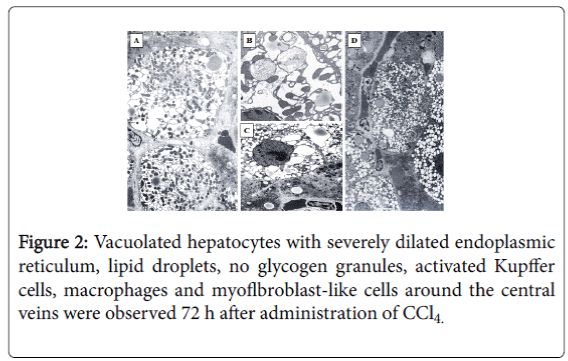gastrointestinal-digestive-system-severely-dilated-endoplasmic
