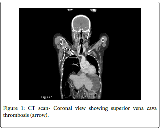 gastrointestinal-digestive-system-showing-superior