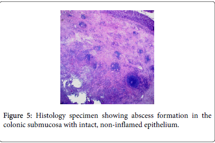 gastrointestinal-digestive-system-sigmoid-colon