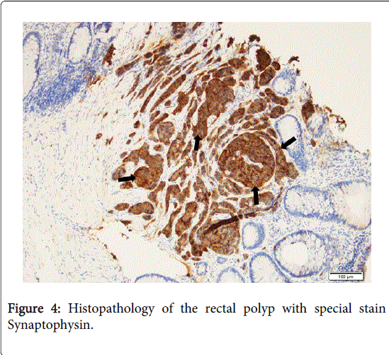 gastrointestinal-digestive-system-special-stain