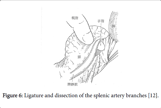 gastrointestinal-digestive-system-splenic-artery