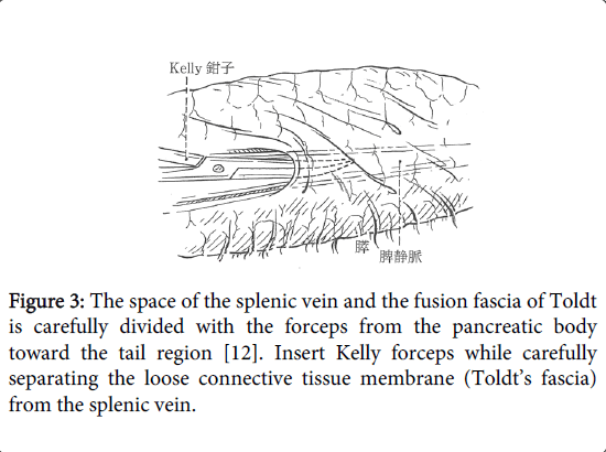 gastrointestinal-digestive-system-splenic-vein