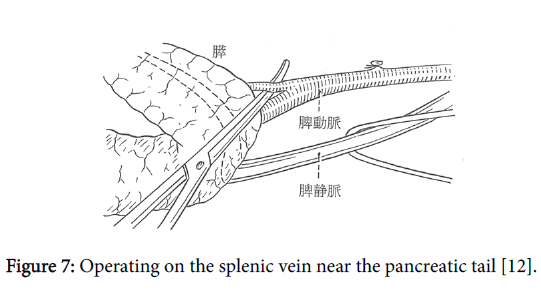gastrointestinal-digestive-system-splenic-vein