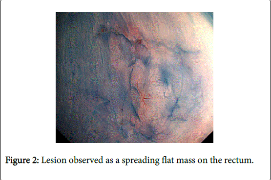 gastrointestinal-digestive-system-spreading-flat