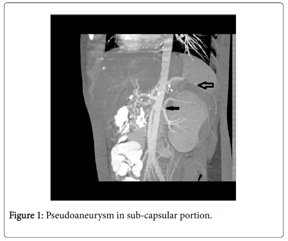 gastrointestinal-digestive-system-sub-capsular-portion