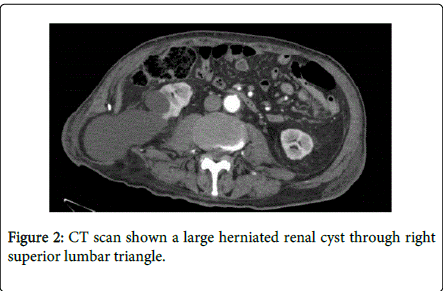 gastrointestinal-digestive-system-superior-lumbar