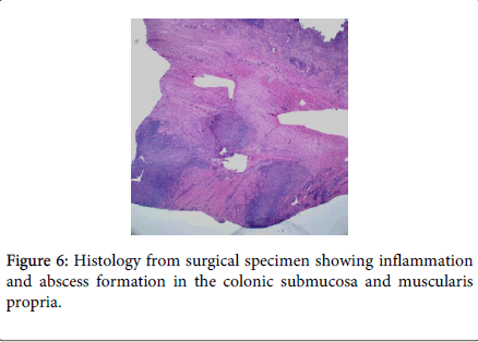 gastrointestinal-digestive-system-surgical-specimen
