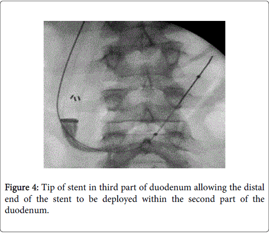 gastrointestinal-digestive-system-third-part