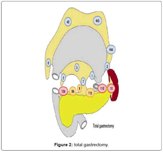 gastrointestinal-digestive-system-total-gastrectomy