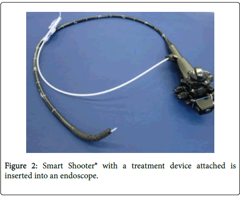 gastrointestinal-digestive-system-treatment-device