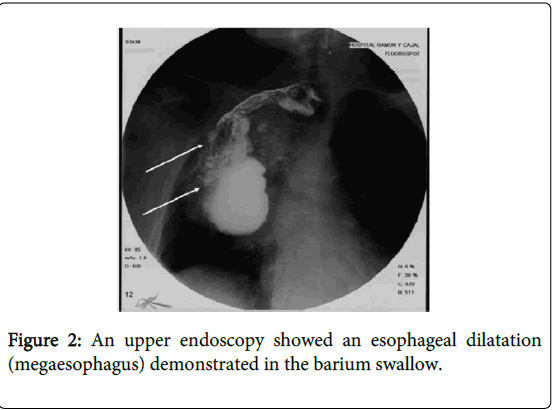 gastrointestinal-digestive-system-upper-endoscopy