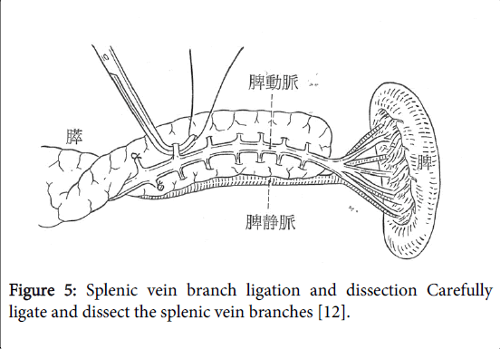 gastrointestinal-digestive-system-vein-branches