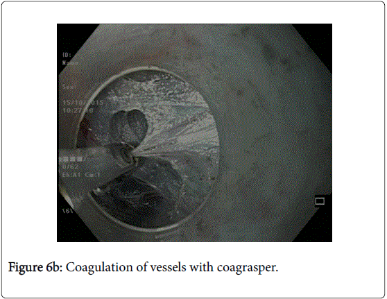 gastrointestinal-digestive-system-vessels-coagrasper