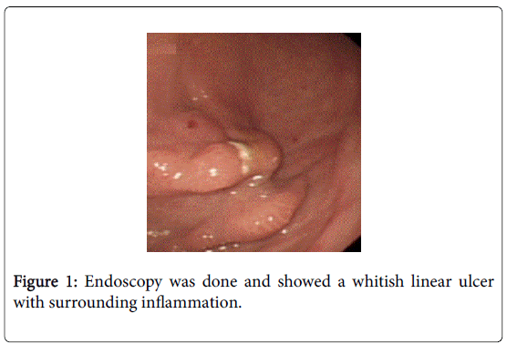gastrointestinal-digestive-system-whitish-linear