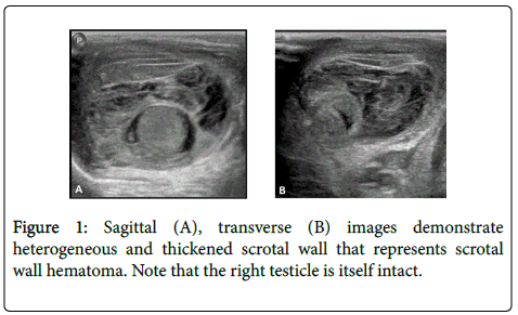 gastrointestinal-digestive-thickened-scrotal