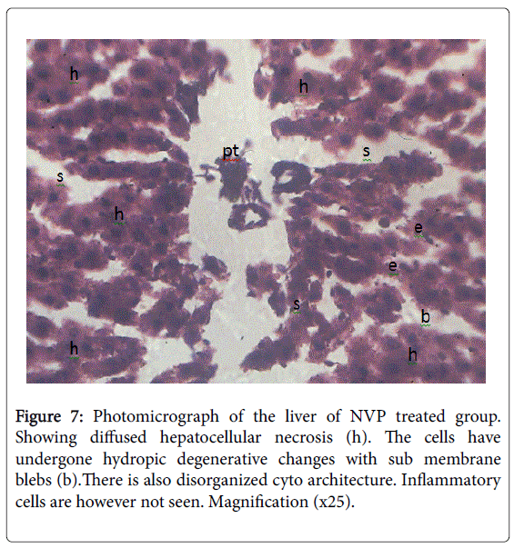 gastrointestinal-digestive-undergone-hydropic-degenerative