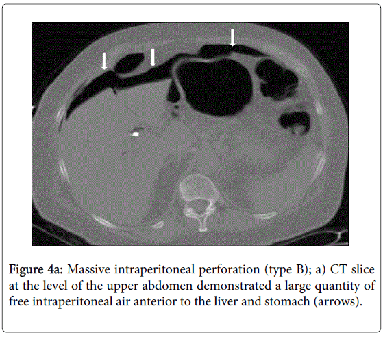 gastrointestinal-digestive-upper-abdomen-demonstrated