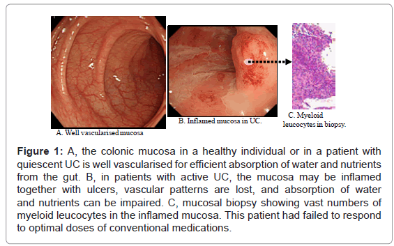 gastrointestinal-digestive-vascularised-efficient-absorption