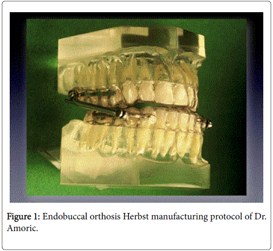 generalpracticeEndobuccalorthosis