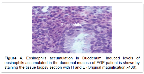 Eosinophilic Gastroenteritis Natural Treatment Eosinophilic Gastroenteritis Natural Treatment