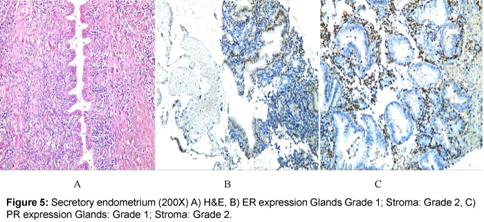 gynecologic-oncology-secretory-endometrium