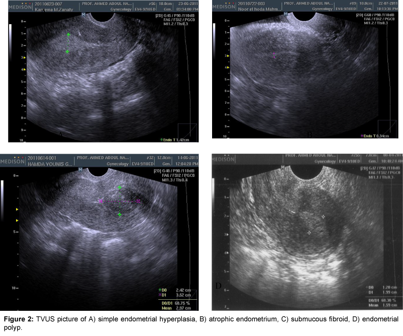 Assessing And Treating Sexual Function After Vaginal Surgery